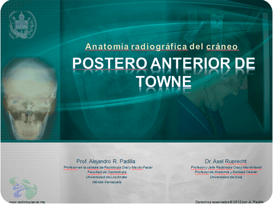 La Monobloc: la silla humilde que desnuda nuestras prioridades