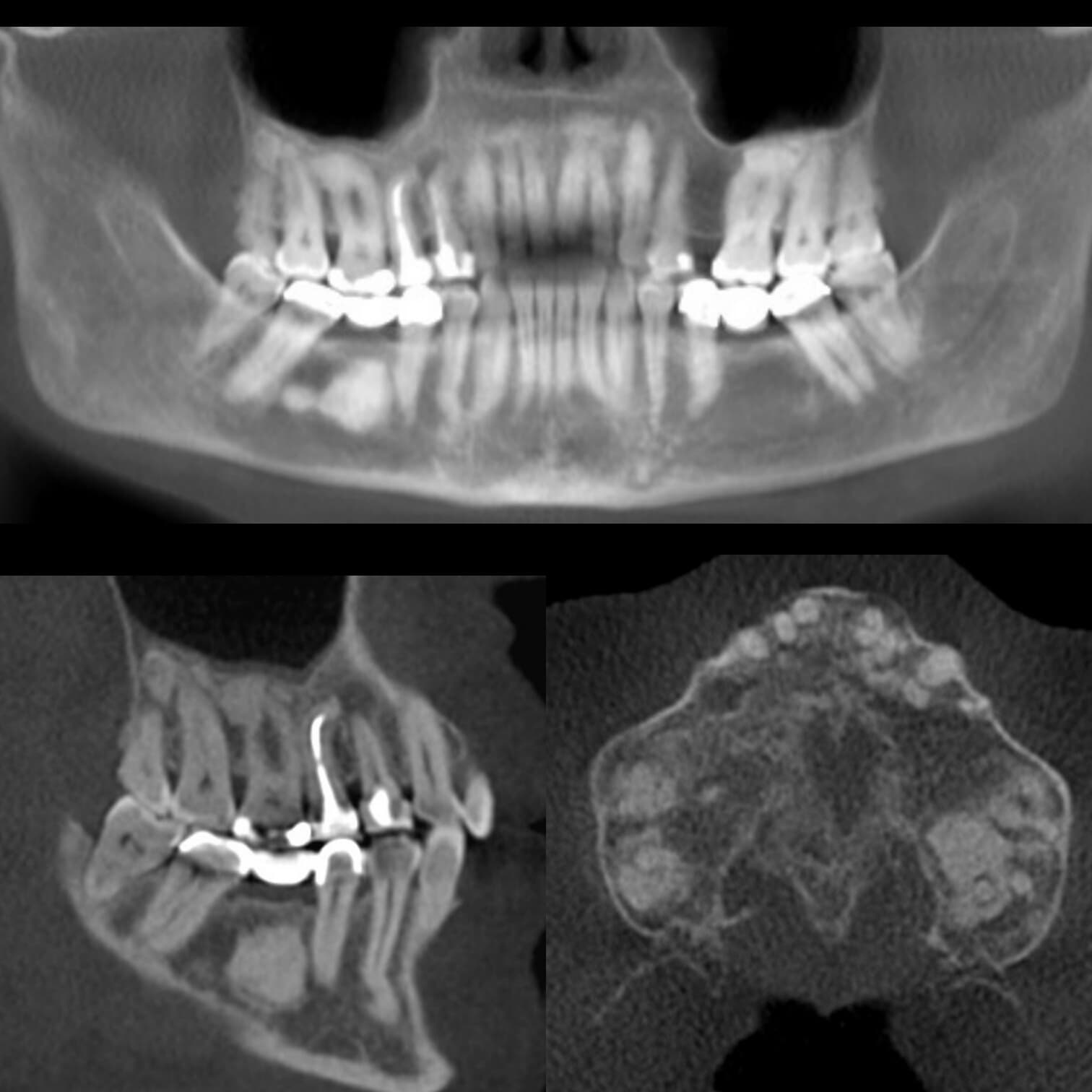 El banquero que abrió las puertas: Giannini y la banca al servicio del pueblo